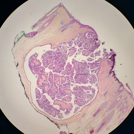 FrenchPath's profile picture. Pathologist in France. AI and digital pathology enthusiast. Together we stain stronger.