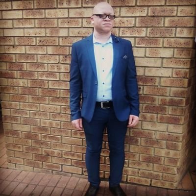 Motivational speaker -Entrepreneur-MC-Model-albinism activist-I am colorful #Thetalkswithbuhle