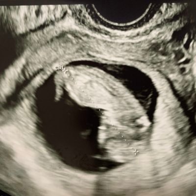 InvisibleCradle's profile picture. 元・大学病院臨床検査技師 → 35歳で医療データサイエンティスト📊 | 一児の父 | 不妊治療×データサイエンス📈 | キャリア転職👔 | 写真術📷 | 子育てと教育👪 📌noteもやっています