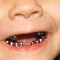 Silver Teeth (@edgar24691) 's Twitter Profile