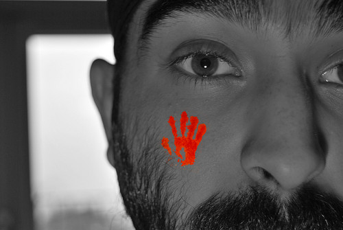 manjitriyat's profile picture. Emergency Medicine/Intensive Care Medicine (aka Stockholm Syndrome). All views own.