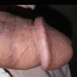 Byo