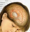 _BrainCancer's profile picture. tweeting about Brain-Cancer. informative about brain cancer