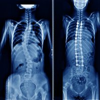Leeds Spine Fellowship (@spineleeds) 's Twitter Profile Photo Leeds Spine Fellowship (@spineleeds) 's Twitter Profile Photo