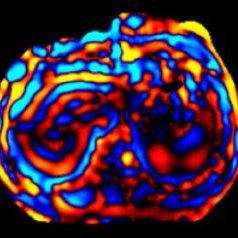 Official Twitter page for the Society of Abdominal Radiology Liver Fibrosis DFP. Promoting the study of Liver Fibrosis. No commercial bias/promotion intended.