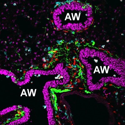 We focus on the Cell & Mol mechanisms that drive onset, maintenance, and resolution of the imm resp towards pathogens. Tweets curated by Kamal or lab.