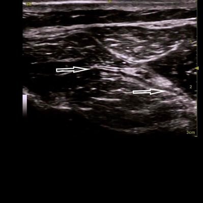 NerveVictoria's profile picture. A clinical team dedicated to bringing the best possible outcomes for those with neurologic injuries and diseases with an open mind and big dreams.