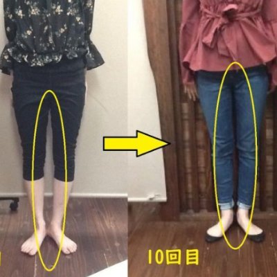 福岡美脚o脚矯正専門センター 骨盤王国 Kotsubanhanare Twitter