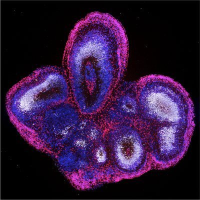 We study neurodevelopment, using brain organoids, at UC Irvine