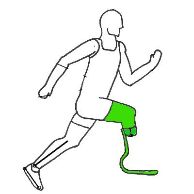 OrthosolutionO's profile picture. orthosolution is place where artificial limbs(prostheses) and suportive devices are made to improve the quality of life of individual living with disabilities