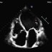 Imagen Cardiaca H12O (@imagcardio_h12o) Twitter profile photo Imagen Cardiaca H12O (@imagcardio_h12o) Twitter profile photo