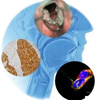Head and Neck Cancer Research Group (@headneckgroup) 's Twitter Profile