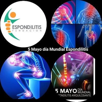 Espondilitis Quinta Región,
Ayudando, apoyando #YoTengoEspondilitis