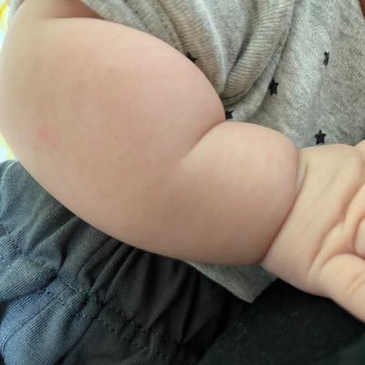 2020年2月第一子出産👶🏻30代🙋♀️子宮口全開からの緊急帝王切開✂︎自閉スペクトラム症🎀幼稚園→療育園へ転園✌️情報収集&無言フォロー失礼します🙇♂️🙏🏻💦育児、発達、日常、旦那の愚痴など何でも呟く雑多垢✌️いいねは応援、共感、見たよなど色んな感情で押しまくるいいねおばさん🙋♀️