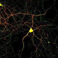 Ravi Muddashetty Lab (@ravimlab) 's Twitter Profile