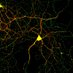Ravi Muddashetty Lab (@ravimlab) Twitter profile photo Ravi Muddashetty Lab (@ravimlab) Twitter profile photo