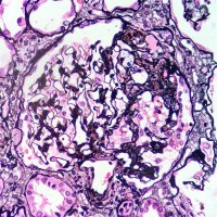 Nephro_path(@NephroPath) 's Twitter Profile Photo