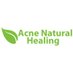 Acne Natural Healing (@acnenatural) Twitter profile photo Acne Natural Healing (@acnenatural) Twitter profile photo
