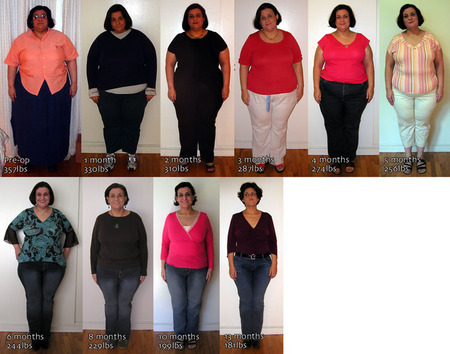 You can LOSE 20 to 30 lbs per month with this NATURAL product, without dieting, exercising,prescriptions or surgical interventions!!
Lacks side-effects.