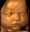 3d_ultrasounds's profile picture. We provide the best services for expecting parents to bond with their baby using 3D Ultrasounds in Orlando and 4D Ultrasounds in Orlando.