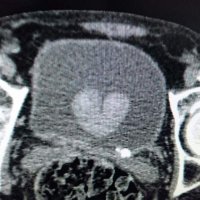 Uro-Bierzo (@urobierzo) 's Twitter Profile Photo