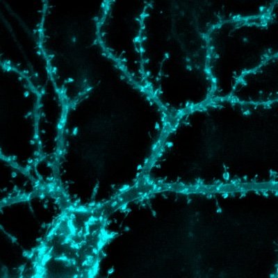 We study how synapses work at the molecular level because it is important for understanding how the brain works normally and why it does not work in diseases.