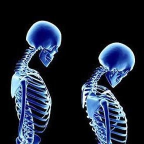 ESHT_FLS's profile picture. We provide a comprehensive Post Fracture Bone Health & Osteoporosis Assessment working towards fracture prevention.