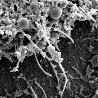 Glasgow Biofilm Research Network (@glasgowbiofilms) 's Twitter Profile Photo Glasgow Biofilm Research Network (@glasgowbiofilms) 's Twitter Profile Photo
