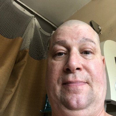 I have bone marrow Cancer
All my life
I am Great full to live in the USA
I am Great full
I am Great full for President Trump
