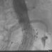 MCW Vascular and Endovascular Surgery (@mcwvascsurg) Twitter profile photo MCW Vascular and Endovascular Surgery (@mcwvascsurg) Twitter profile photo