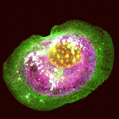 Our goal is to understand the roles of mechanical signals generated at the interface between membrane and cytoskeleton during tumor-associated biological events