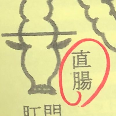 j_netman's profile picture. 40代男性。直腸神経内分泌腫瘍、NET G2（ki67、約4%）、腫瘍4mm、断端陰性、静脈浸潤あり、リンパ節転移なし、肝転移なし。 術後の排便障害が気になり、セカンドオピニオンを受け、経過観察と決断。2025年10月現在、異常なく元気☺️