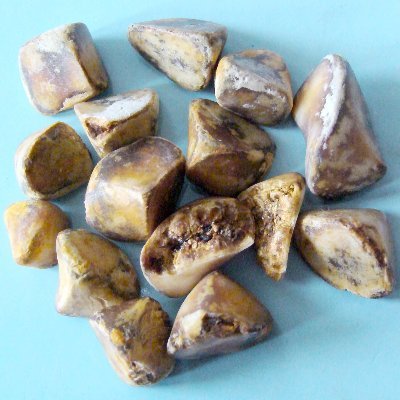 Gallstones Free