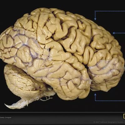 neurocirujano colombiano egresado santa casa de rio de janeiro y fellow en inca de rio y azienda ospedaliera di verona (italia)