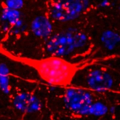 Lab at UCLA Neurology dedicated to investigating circuit dysfunction and therapeutic strategies for neurologic diseases. https://t.co/8yfGTnRz8S