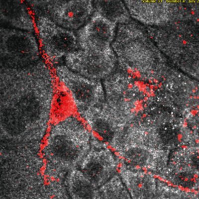 Official journal of the International Federation of Pigment Cell Societies (IFPCS) and the Society for Melanoma Research (SMR). Published by Wiley.