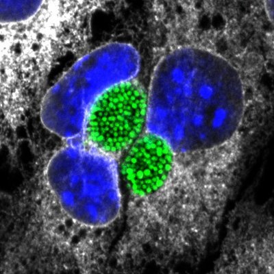 The SixtLab, headed by Barbara Sixt, strives to uncover the hid­den protective potential of pathogen-suppressed cellular defense programs.