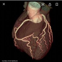 USC Cardiothoracic Imaging(@UscradCti) 's Twitter Profile Photo