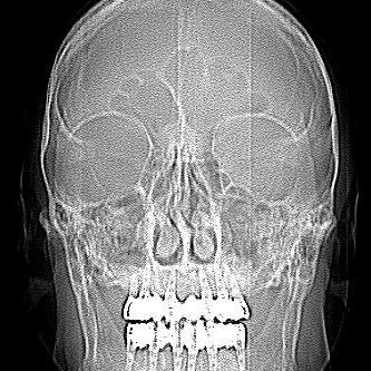 luxusluna's profile picture. Hekim , Radyolog, Cerrah, Öğretim Üyesi, Haklıdan yana!