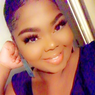 Vitiligo beauty 🦋