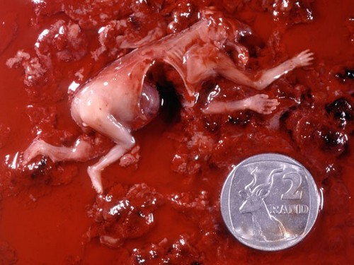 Abort97's profile picture. Abort97 is a non-profit organisation aimed at exposing abortion in order to bring about an end to abortion.