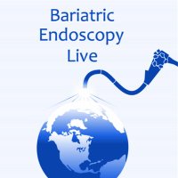 Bariatric Endoscopy Live Global(@BariatricLive) 's Twitter Profileg