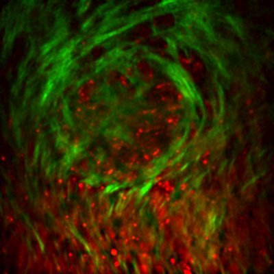 inlightenus's profile picture. InlightenUs - powered by light and curiosity - delivering rapid, non invasive diagnostic technologies for the healthcare needs of the future