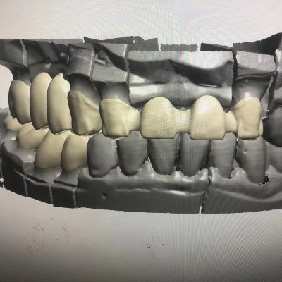 allen3shape's profile picture. I am a 3shape designer. If you need me, please contact. allen3shapedesigner@gmail.com