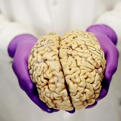 Expert psychiatre près la cour d'appel.
Influenceur psychotropes.
Running, trail, et gamelles.