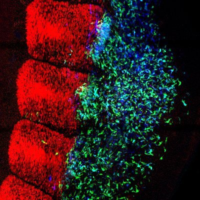 Developmental Biology, trangenic quails, chick and mouse embryos, skeletal muscle