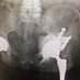 Cleveland Clinic Adult Recon & Research (CCARR) (@cleclinicarthgp) Twitter profile photo Cleveland Clinic Adult Recon & Research (CCARR) (@cleclinicarthgp) Twitter profile photo