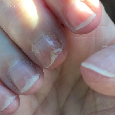 FlexiNail - Do Your Nails Split? Try This (@FlexiNail) / Twitter FlexiNail - Do Your Nails Split? Try This (@FlexiNail) / Twitter