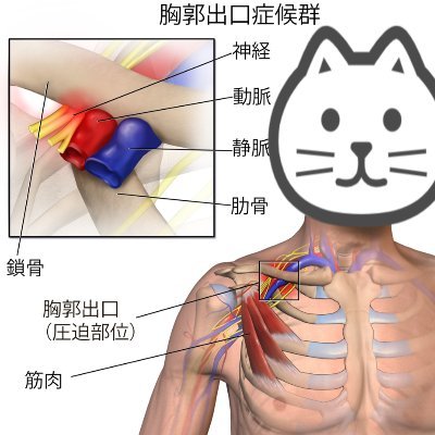 Rego ﾘﾊﾋﾞﾘ 胸郭出口症候群 噛み合わせ症候群 Rego Rehabili Twitter