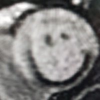 Imran ansari (@dr_imranm) 's Twitter Profile Photo